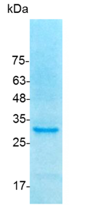 <strong>Fig. 1</strong>: SDS-PAGE analysis of recombinant human FGF-11 Isoform 1