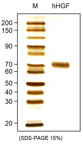 Fig 1: SDS-PAGE analysis of recombinant human HGF, cct-premium derived from insect cells. Sample was loaded in 10% SDS-polyacrylamide gel under non-reducing conditions and stained with silver stain.