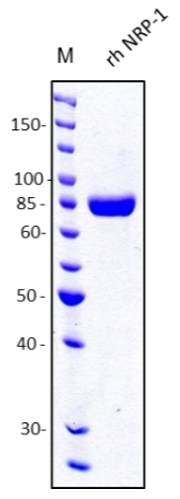 Fig. 1.: SDS-PAGE analysis of recombinant human soluble NRP-1. Sample was loaded in 10% SDS-polyacrylamide gel under reducing conditions and stained with Coomassie blue.
